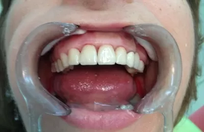 Вега Дентал