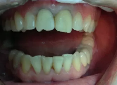 Вега Дентал