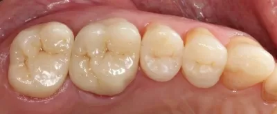 Вега Дентал