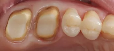 Вега Дентал