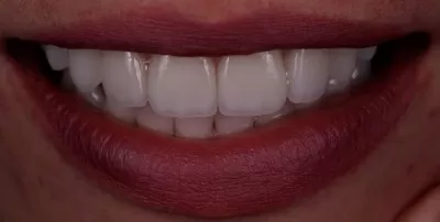 Вега Дентал