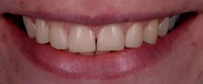 Вега Дентал