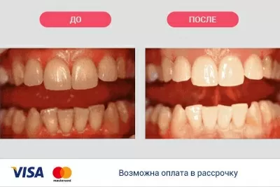 ИриЗДентаЛ