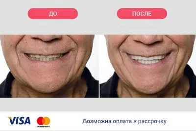 ИриЗДентаЛ