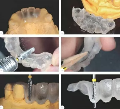 ИриЗДентаЛ