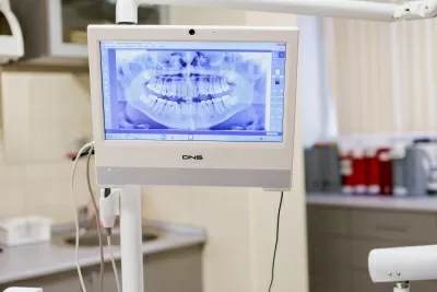 Брекет Систем