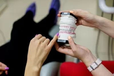 Брекет Систем