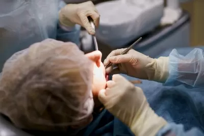 Брекет Систем