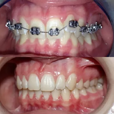 Стоматология R.E.Dent