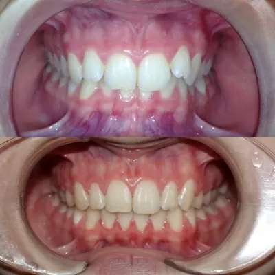 Стоматология R.E.Dent