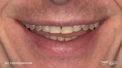 Мастерская улыбок