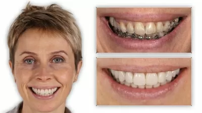 Мастерская улыбок