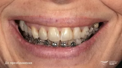 Мастерская улыбок