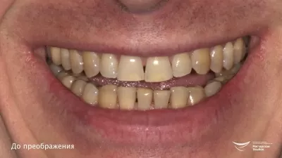 Мастерская улыбок