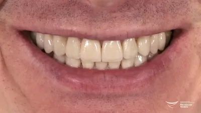 Мастерская улыбок