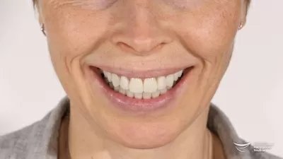 Мастерская улыбок