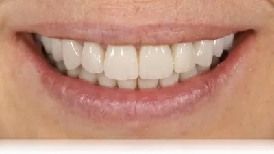 Мастерская улыбок