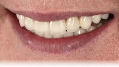 Мастерская улыбок