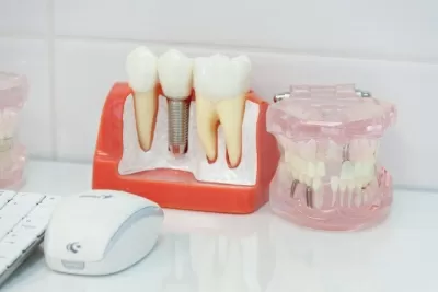 Белый жемчуг