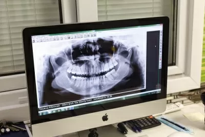 Центр дентальной имплантации