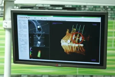 Центр дентальной имплантации