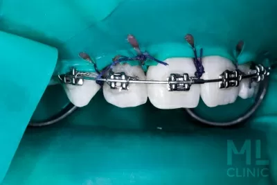 Стоматология ML clinic