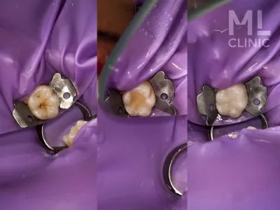 Стоматология ML clinic