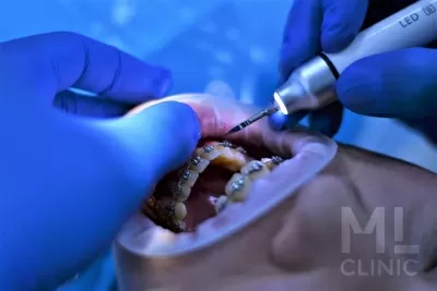 Стоматология ML clinic