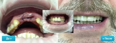 Крепкий Орешек