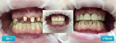 Крепкий Орешек