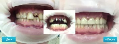 Крепкий Орешек