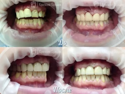 Крепкий Орешек