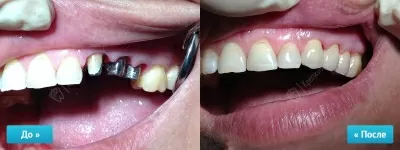 Крепкий Орешек