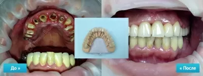 Крепкий Орешек