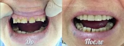 Крепкий Орешек