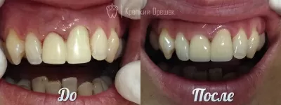 Крепкий Орешек