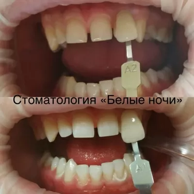 Стоматологическая клиника Белые ночи (Акси Дентал)