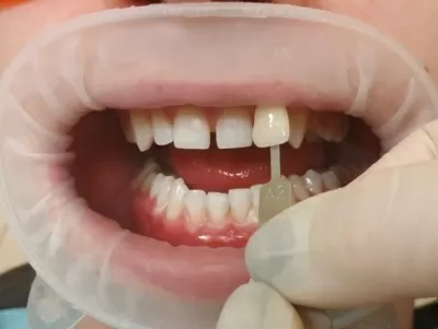 Стоматологическая клиника Белые ночи (Акси Дентал)