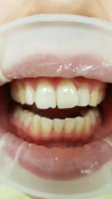 Стоматологическая клиника Белые ночи (Акси Дентал)