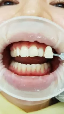 Стоматологическая клиника Белые ночи (Акси Дентал)