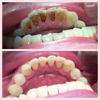 Стоматологическая клиника Улыбайся