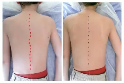 Массажный кабинет на улице Осипенко