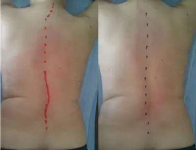 Массажный кабинет на улице Осипенко