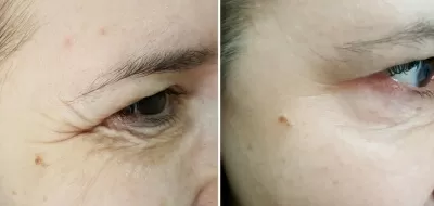 Академия Красоты