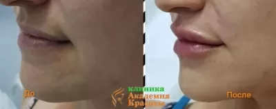 Академия Красоты