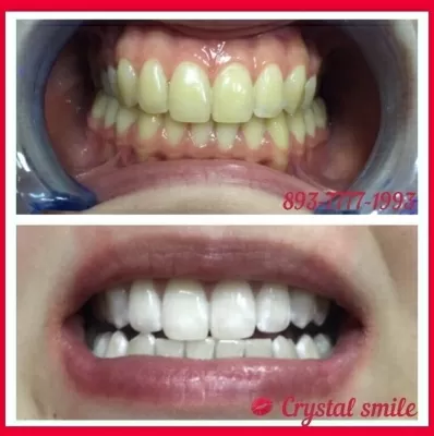 Crystal Smile
