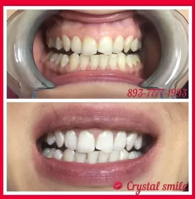 Crystal Smile