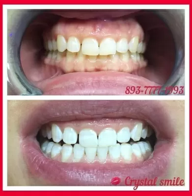 Crystal Smile