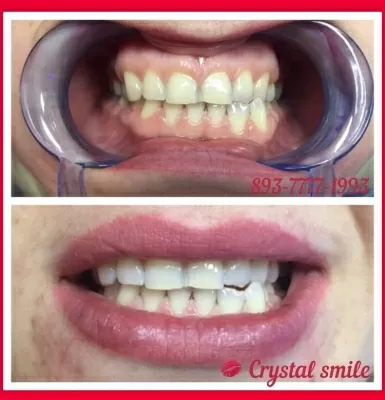 Crystal Smile