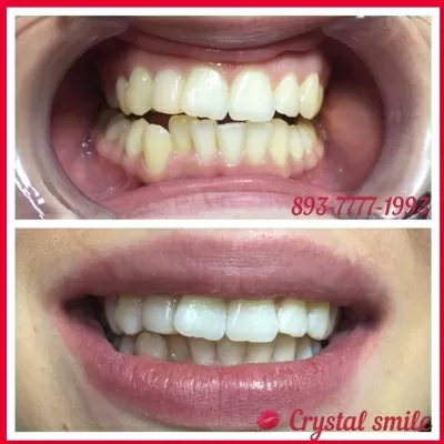 Crystal Smile